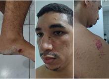 Solidariedade ao estudante da UFRN agredido durante o ato pró-voto impresso